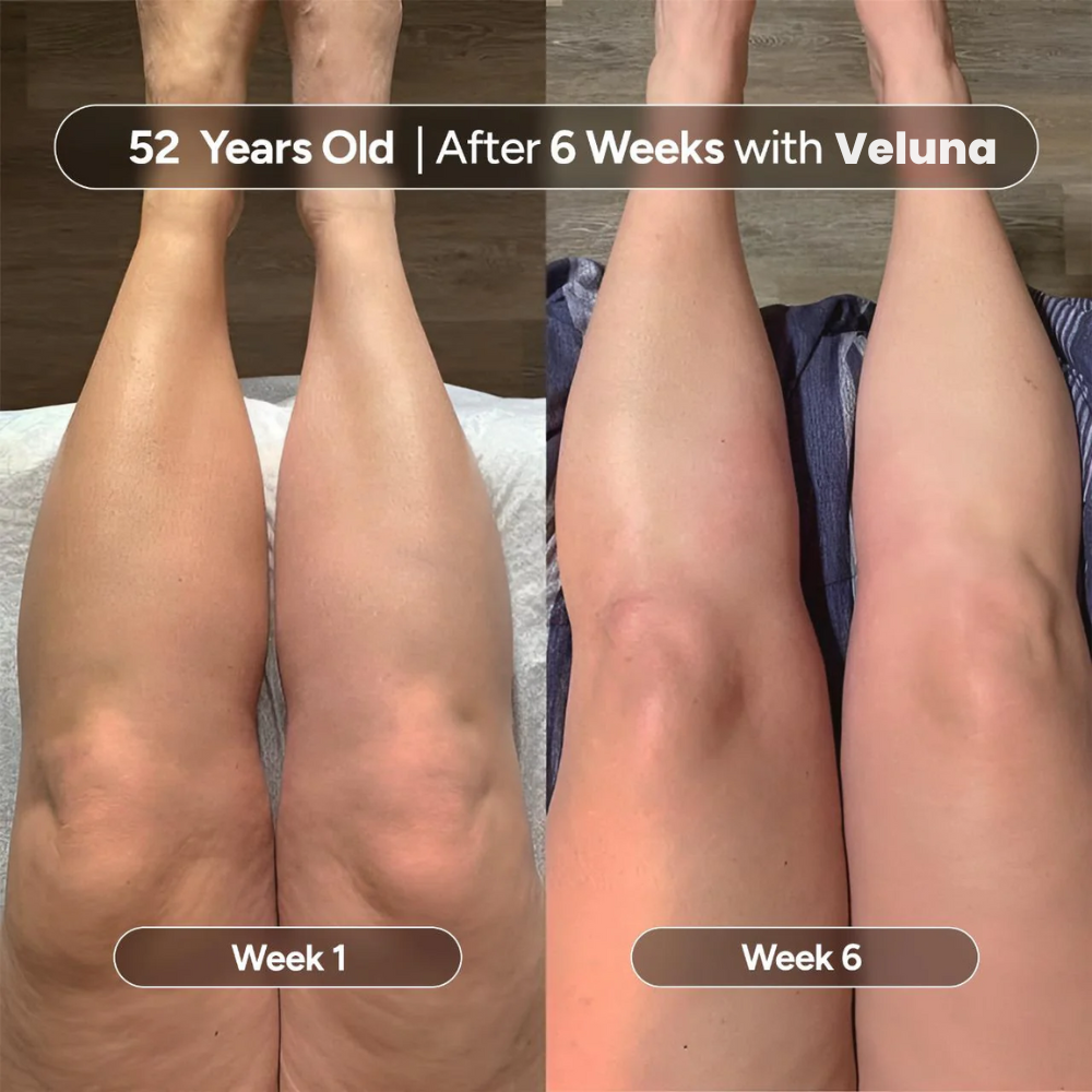 Veluna Anti-Cellulite Massage Oil