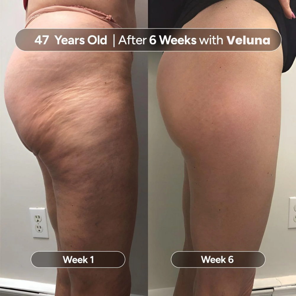 Veluna Anti-Cellulite Massage Oil